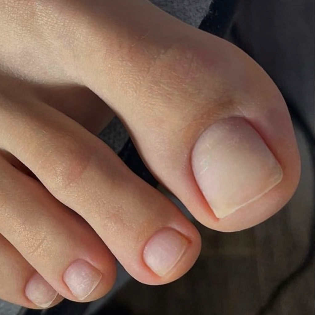 Обработка только пальчиков ног без покрытия