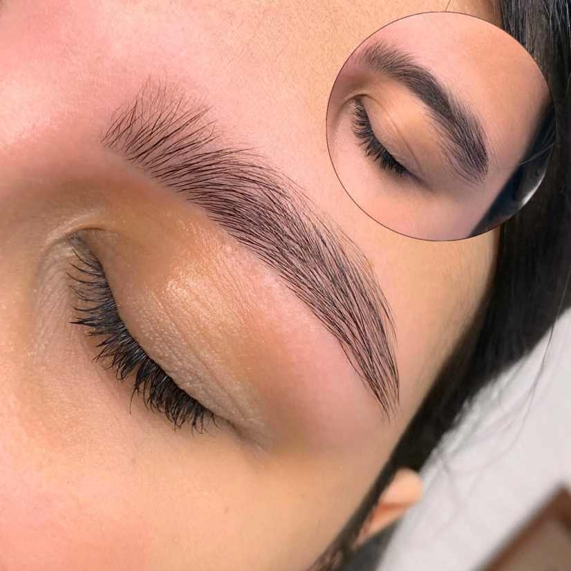 Тотальное прореживание