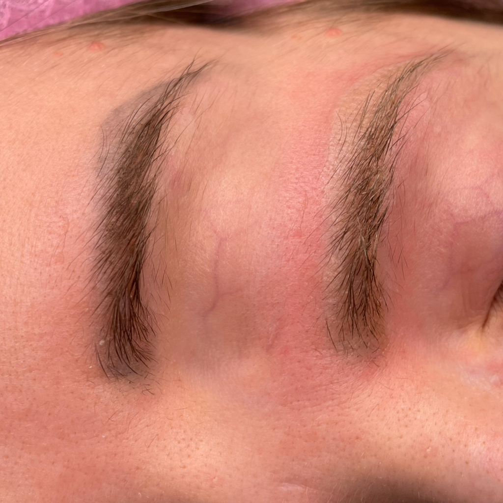 Удаление перманентного макияжа ремувером