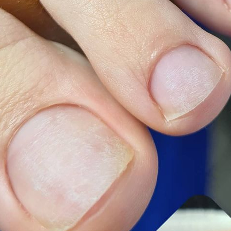 Снятие гель-лака на педикюре