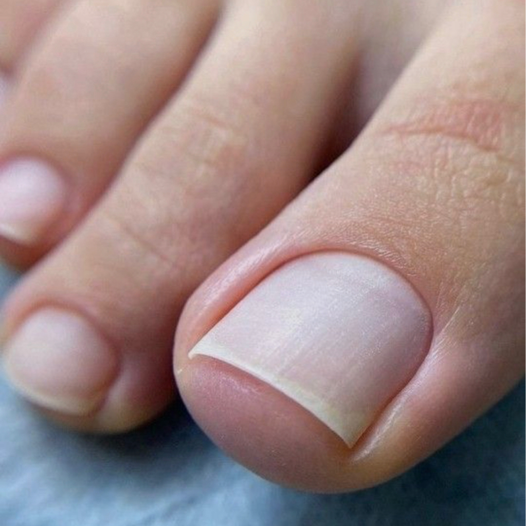 2.2 Обработка пальчиков на ногах без покрытия