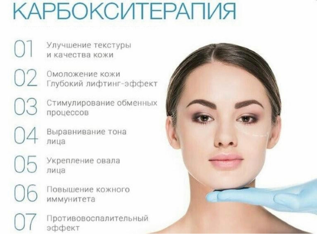 Карбокситерапия