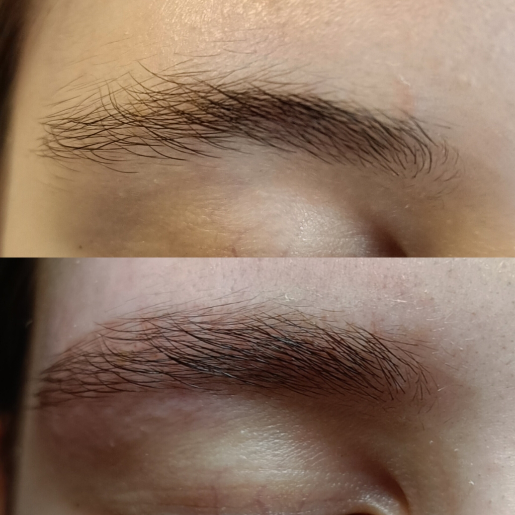 Подростковая коррекция.