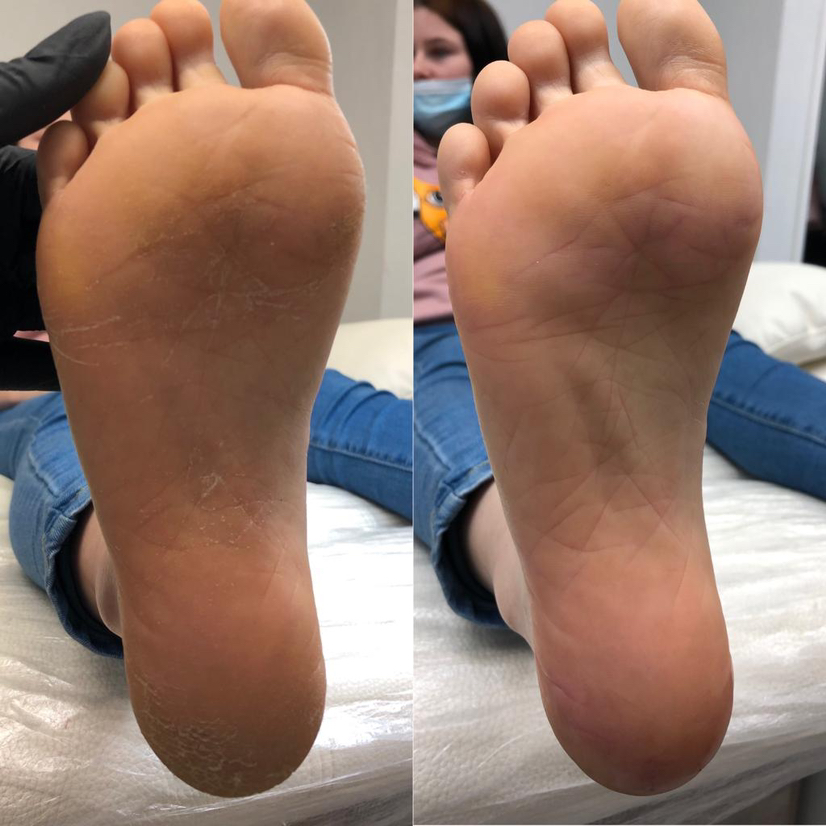 Смарт педикюр (обработка стоп и пальчиков) без покрытия