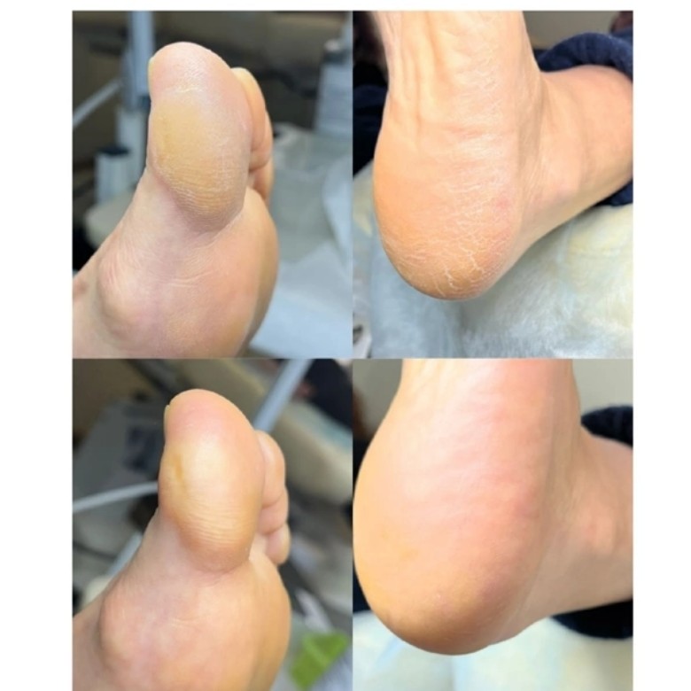 педикюр без покрытия