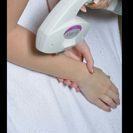 Лазерная эпиляция руки до локтя