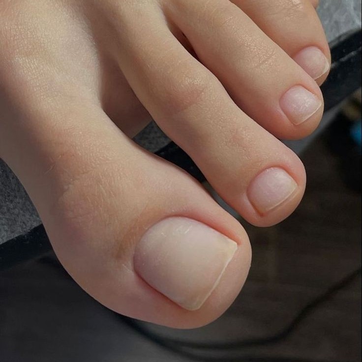 Обработка Пальце Ног