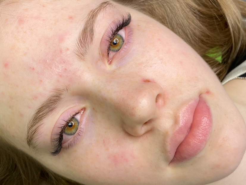 Наращивание классика