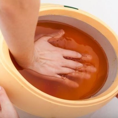 Парафинотерапия