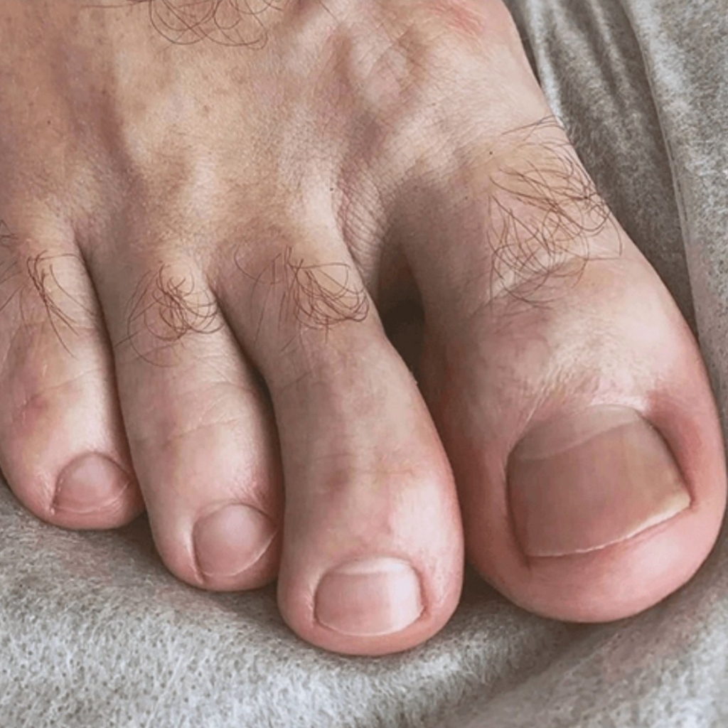 Педикюр мужской