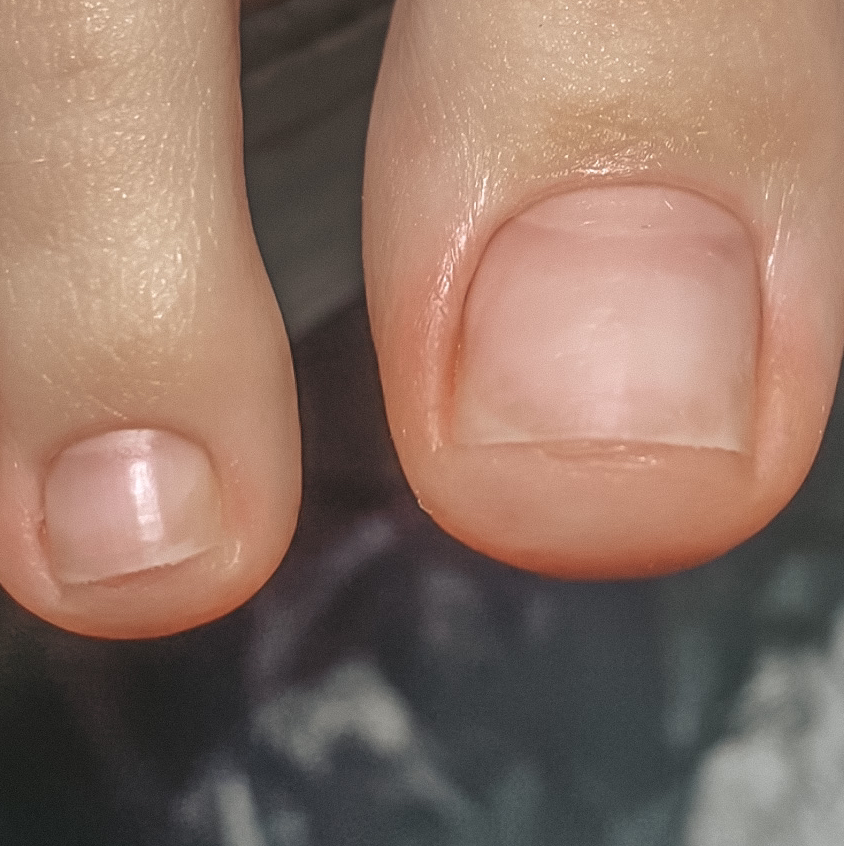 только пальцы