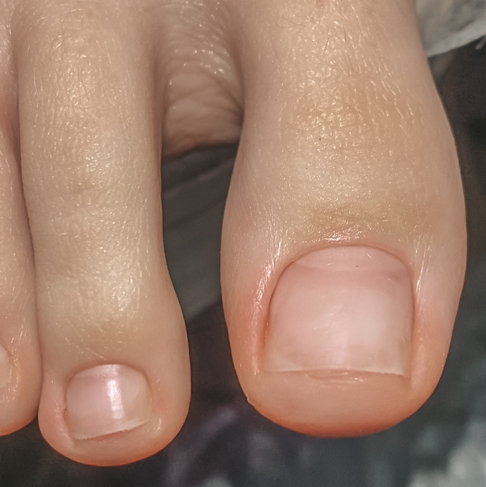 полностью стопа