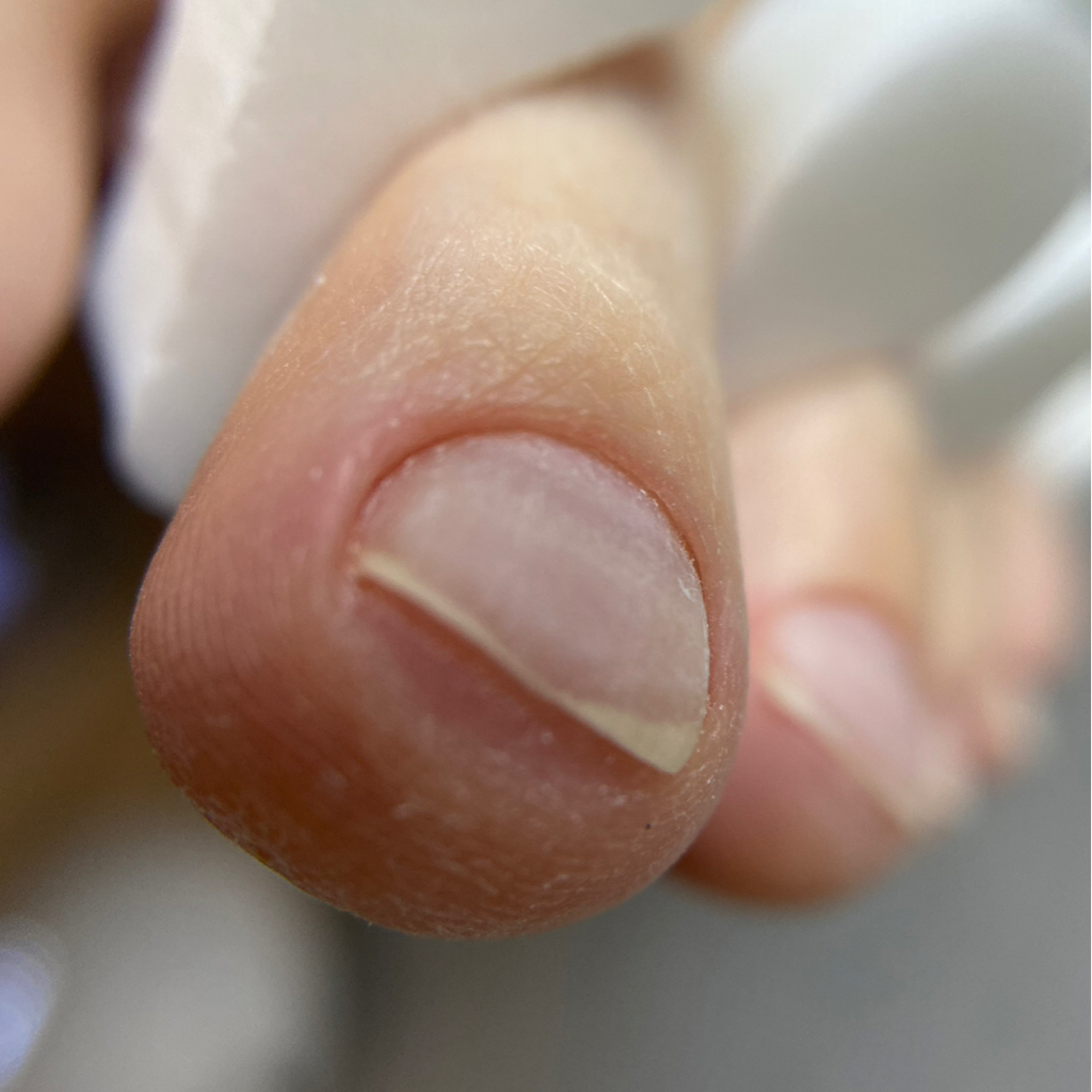 Снятие гель-лака без последующего покрытия