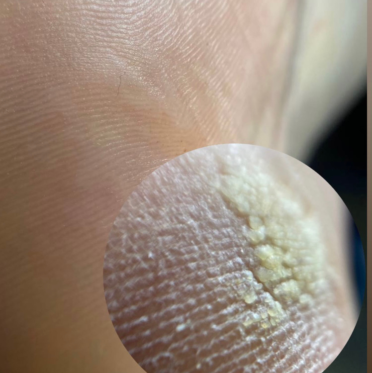 Педикюр гигиенический дисковый (полный, без покрытия)