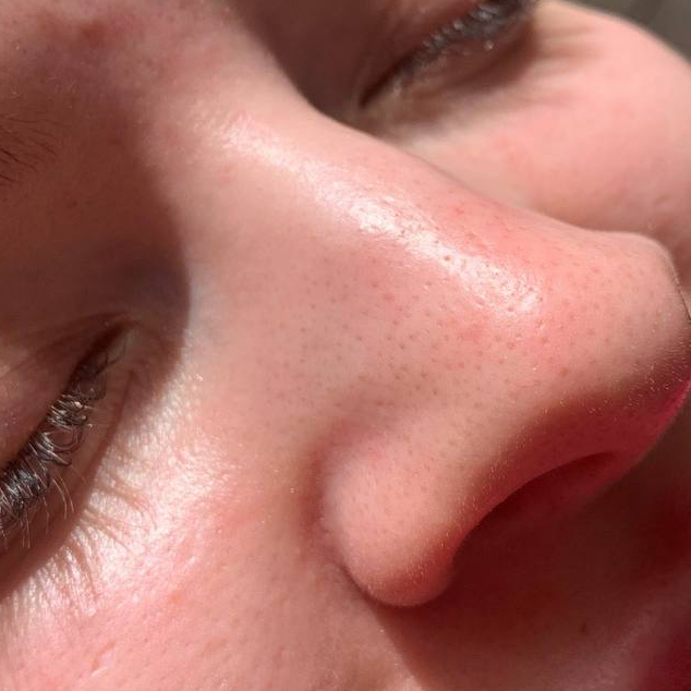 Комбинированная чистка