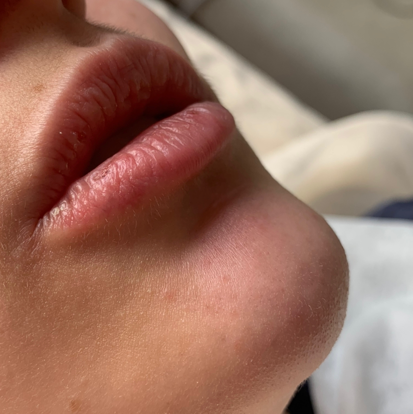 Механическая чистка