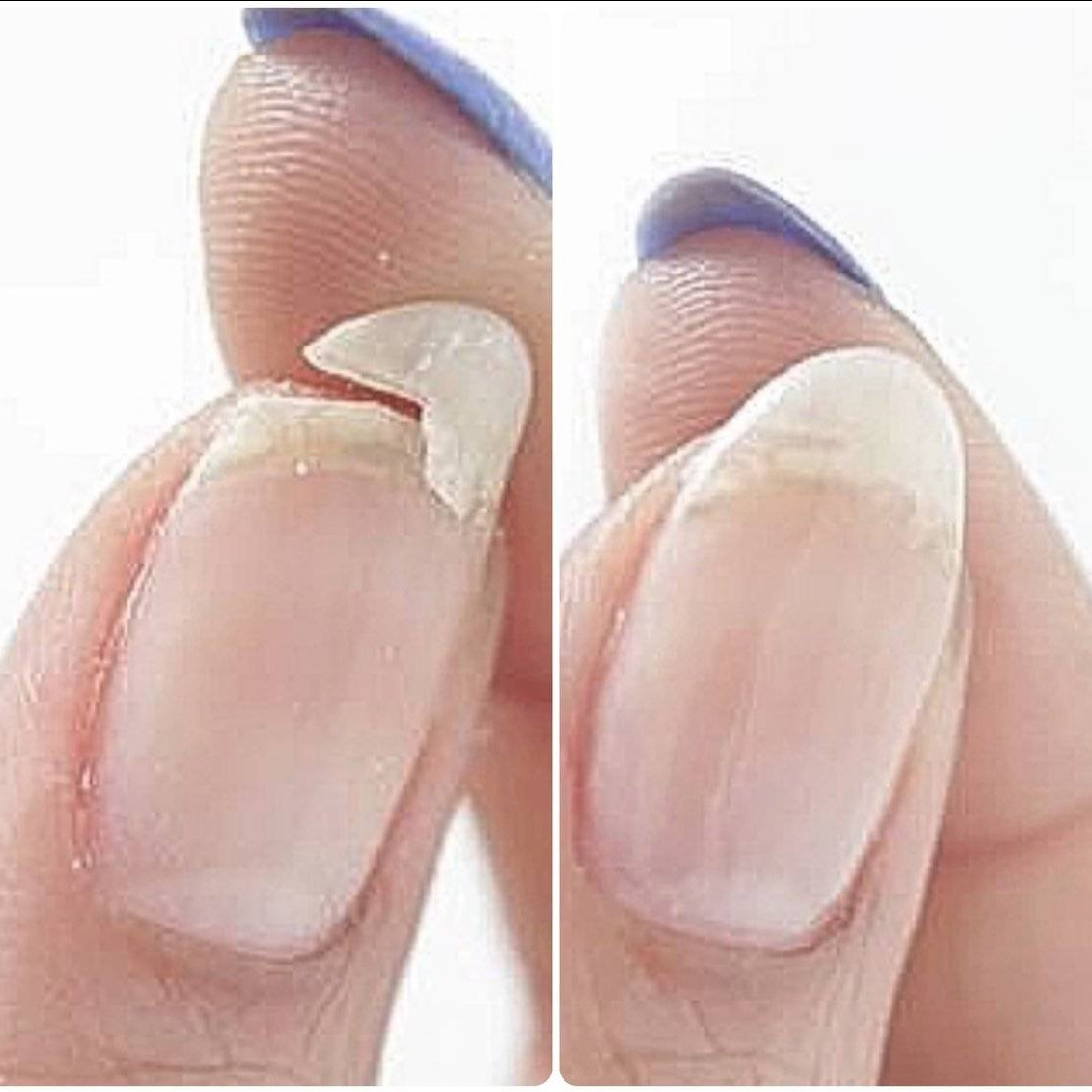 Ремонт - 1 ноготь