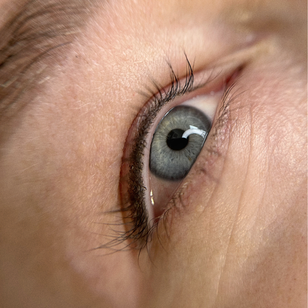 Обновление межреснички