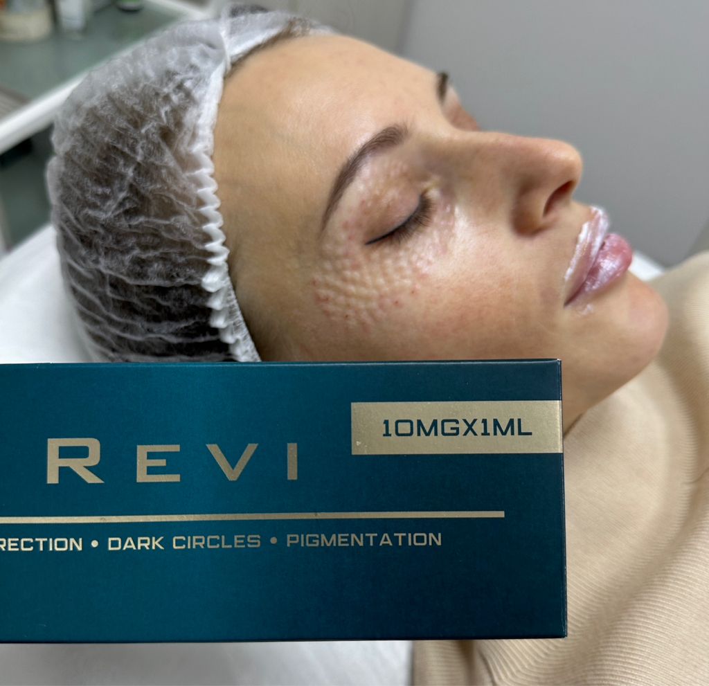 Биоревитализация кожи вокруг глаз препаратом Revi eye.