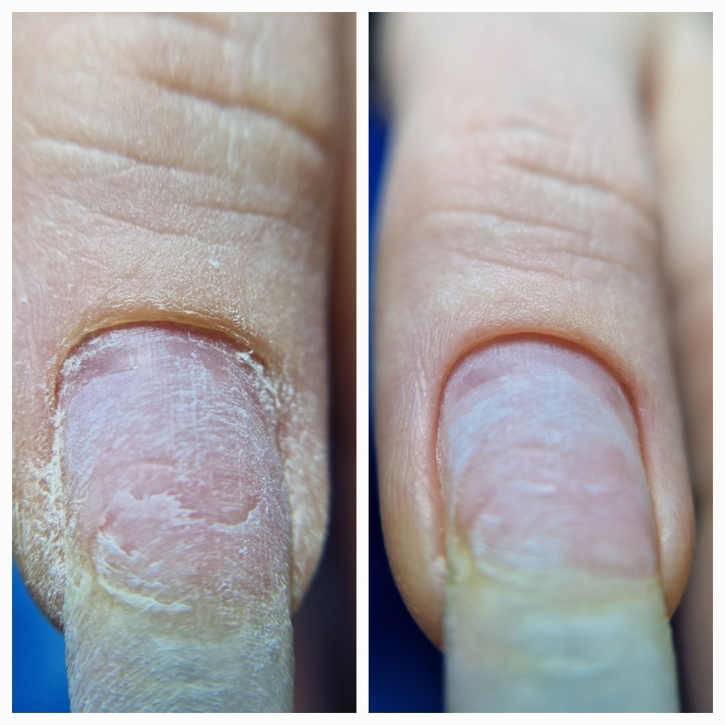 Комбинированный маникюр