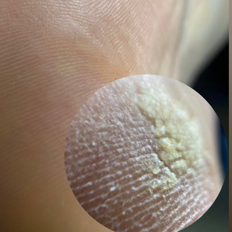 Педикюр гигиенический дисковый  (только стопы)