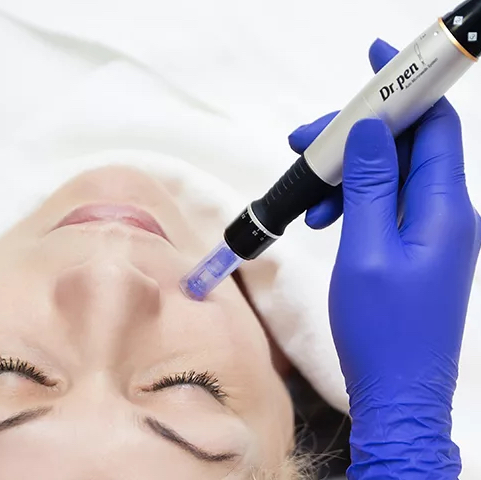 Мезотерапия фракционная ( при добавлении пилинга +1500)