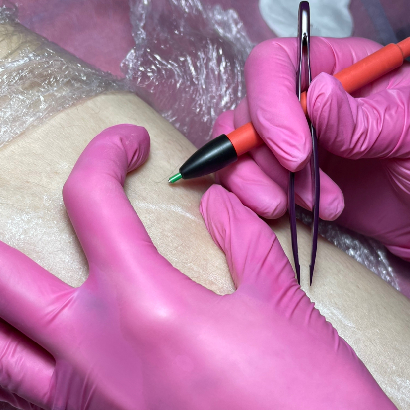 Электроэпиляция 1 час