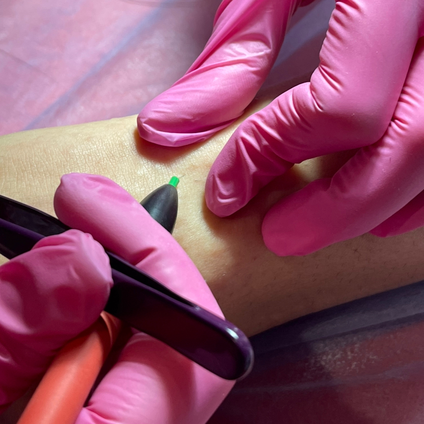 Электроэпиляция 2 часа