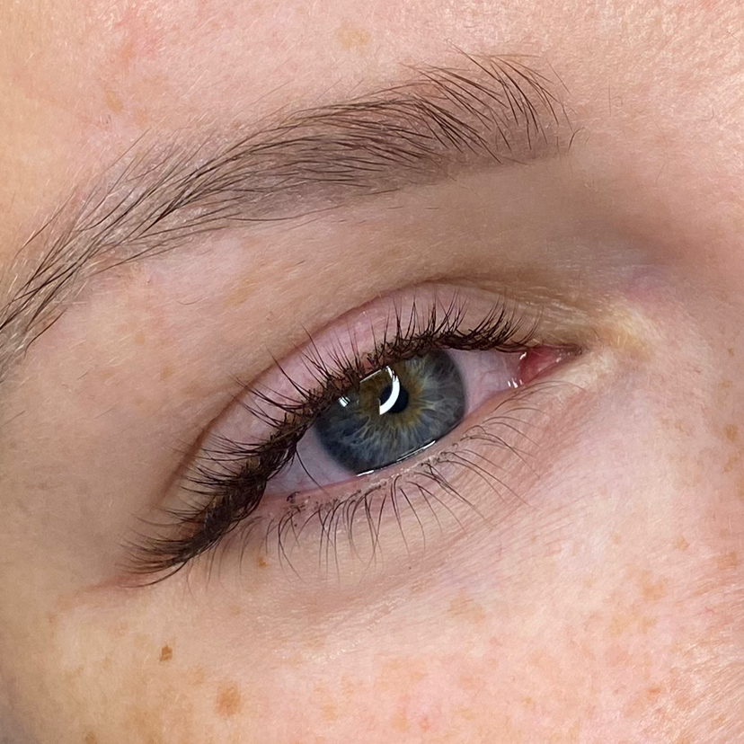 Классическое наращивание (1D)