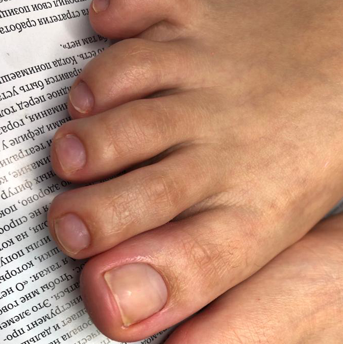 Гигиенический педикюр