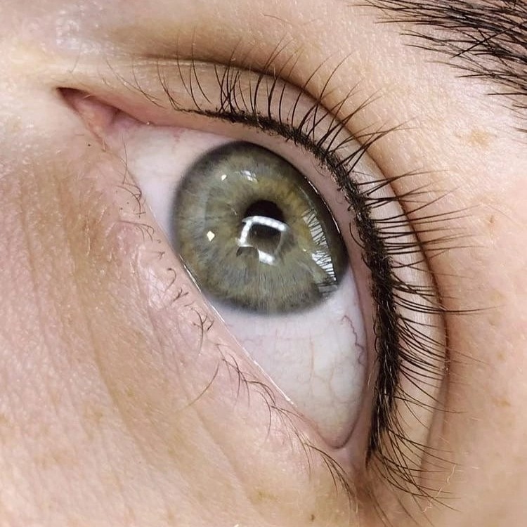 Межресничка