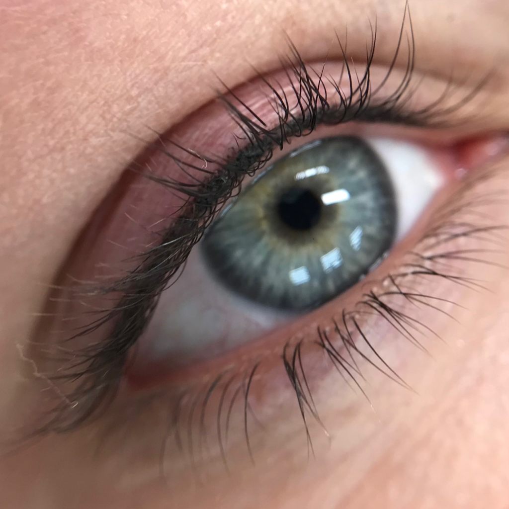 Межресничка