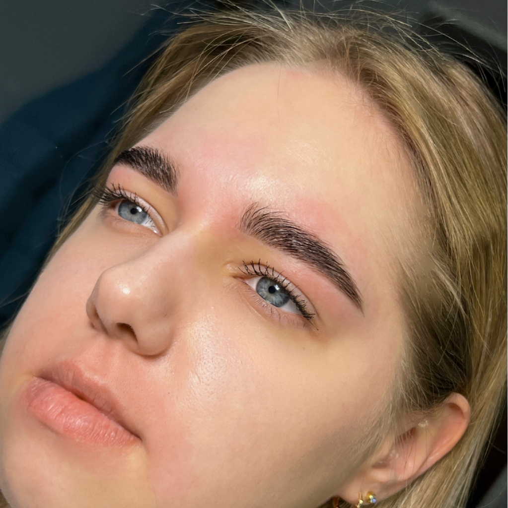 Удаление нежелательных волос