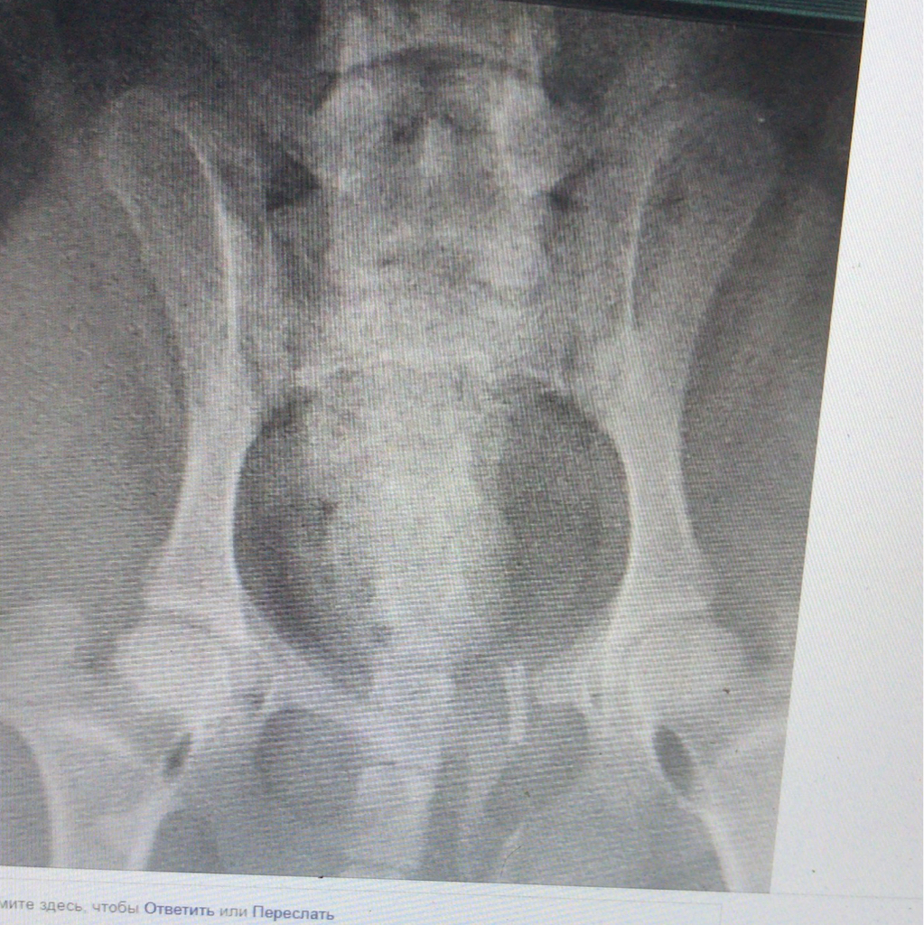 Рентгенографическое исследование