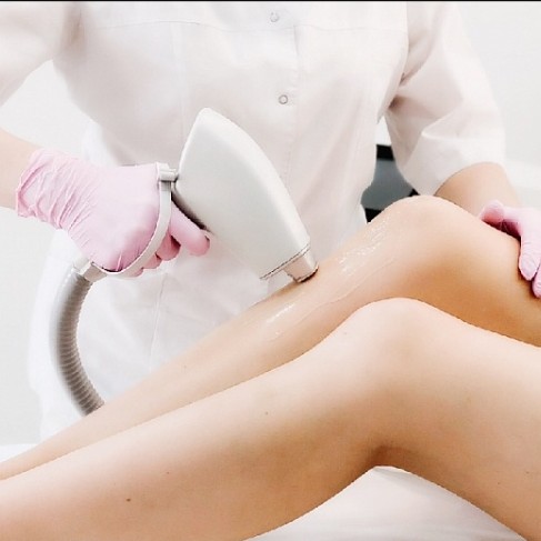 Лазер голени