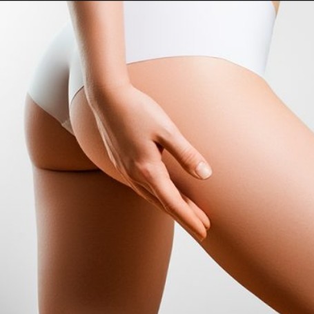 Лазер ягодицы