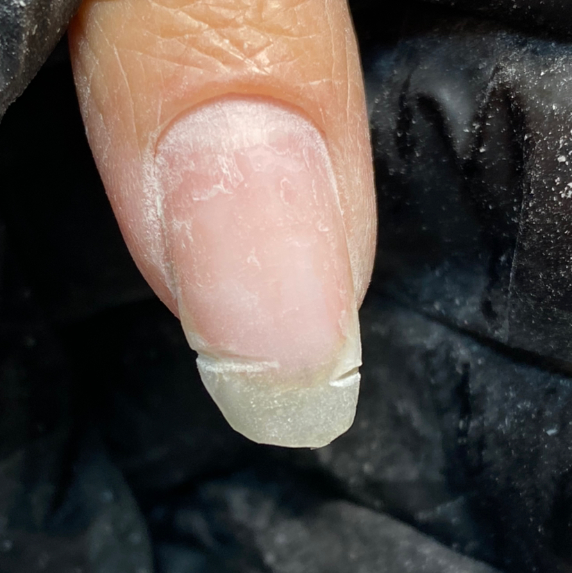 Ремонт ногтей