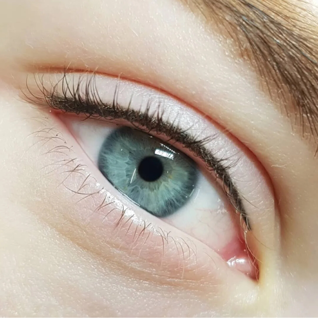 Межресничка