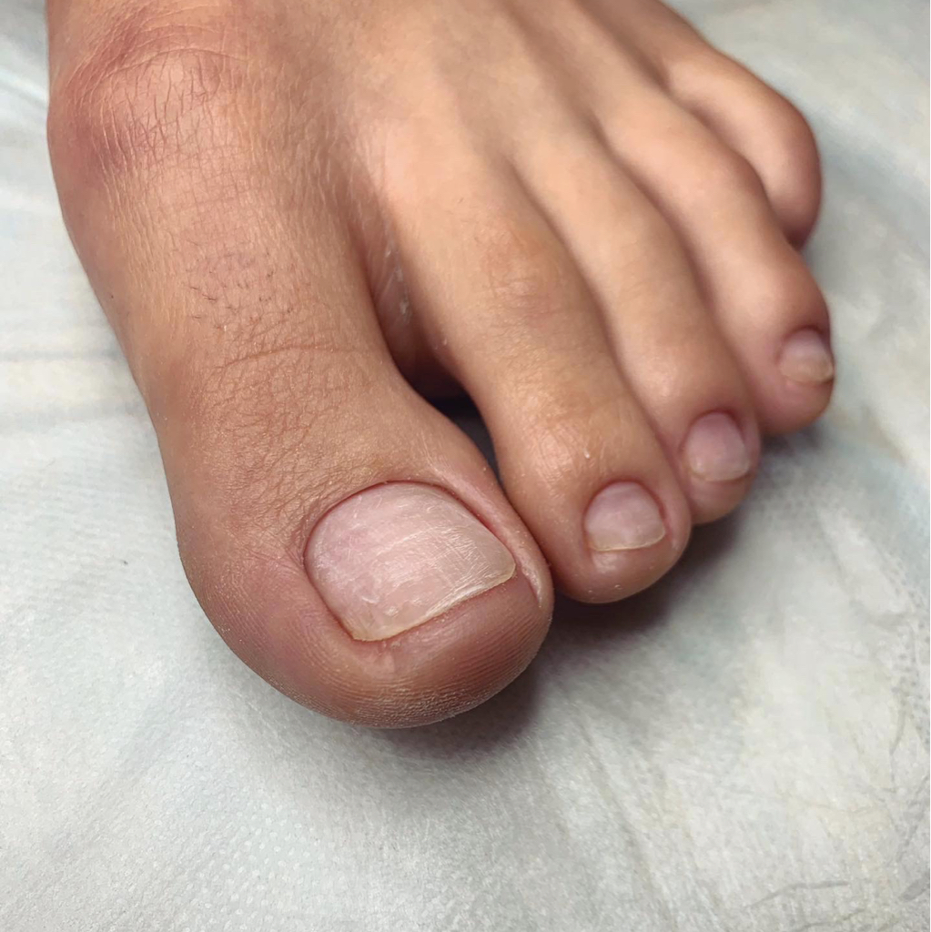 Гигиенический педикюр полный