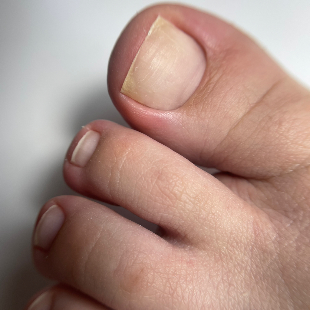 безопасный эстетический педикюр без покрытия