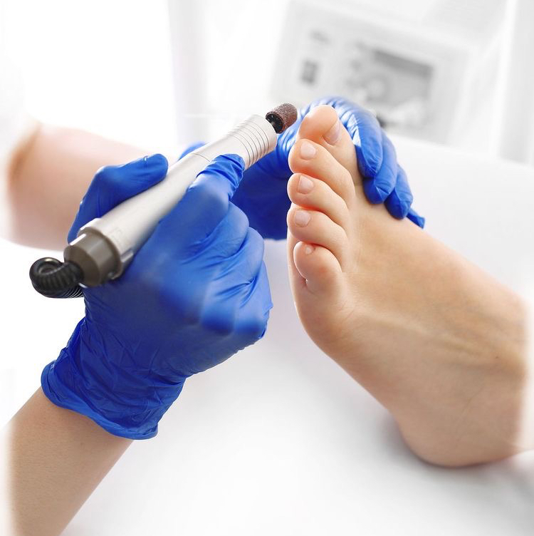 Медицинский педикюр: диагностика стоп методом плантоскопии,консультация,зачистка 1-2 поражённых ногтей,зачистка онихолизиса,уд.стержн.моз.