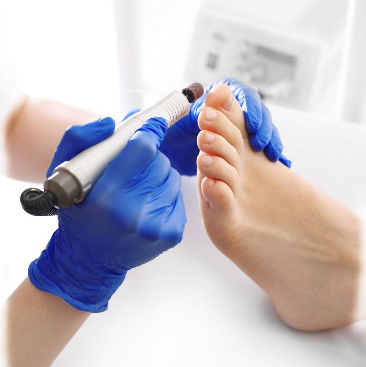 Гигиенический педикюр.