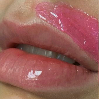 Восковая депиляция  усиков