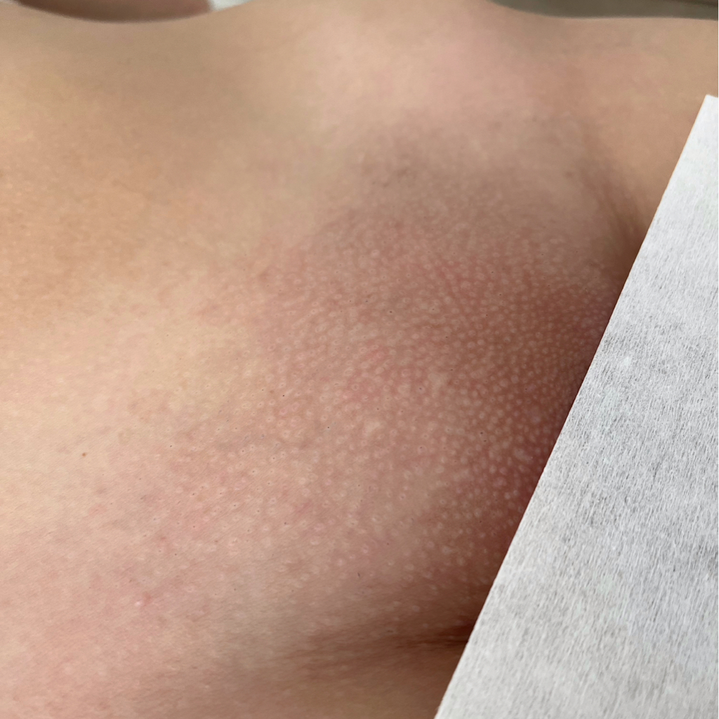 Глубокое бикини