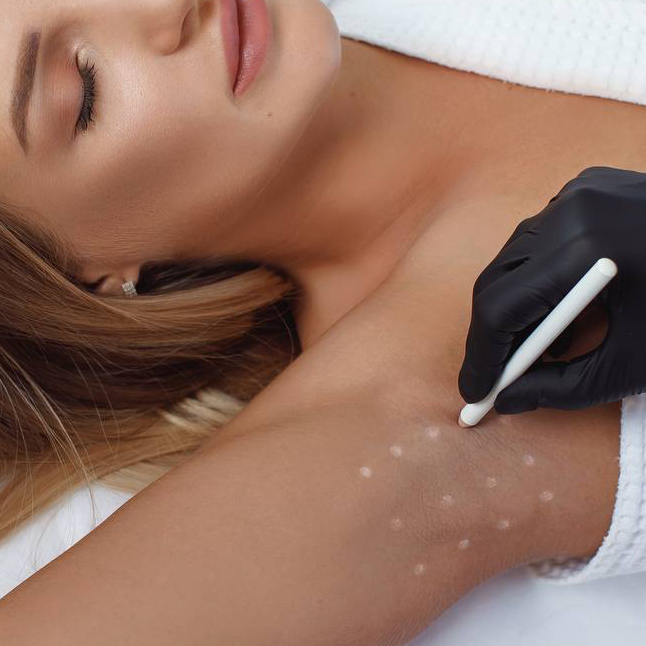 Гипергидроз