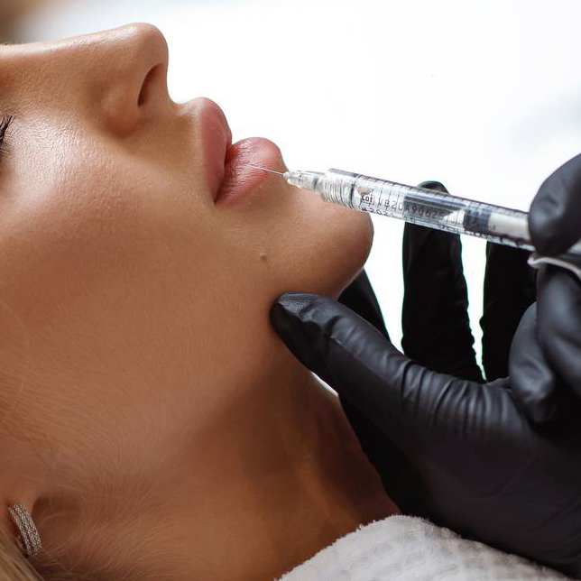 Аугментация губ 1 мл