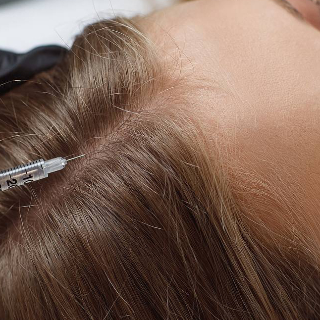 Мезотрихология (курс 10 процедур - скидка 13%)