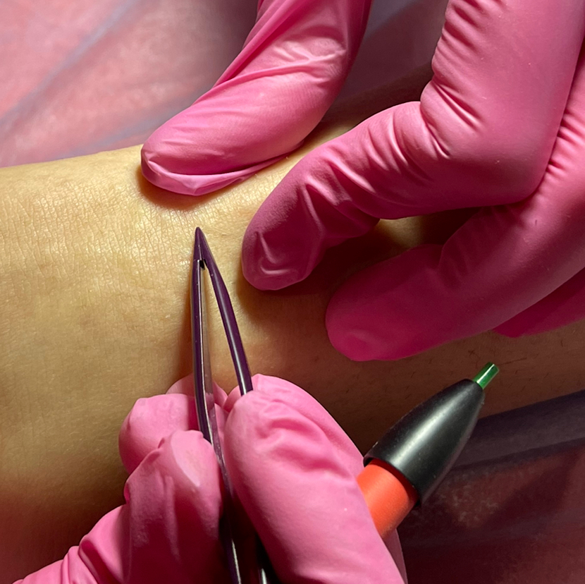 Электроэпиляция 1,5 часа