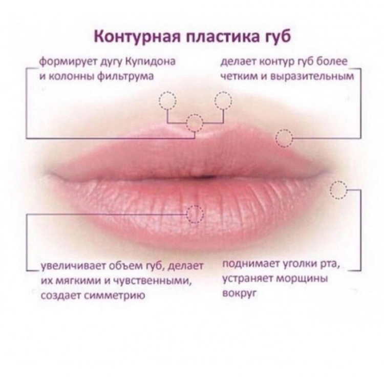 Контурная пластика губ