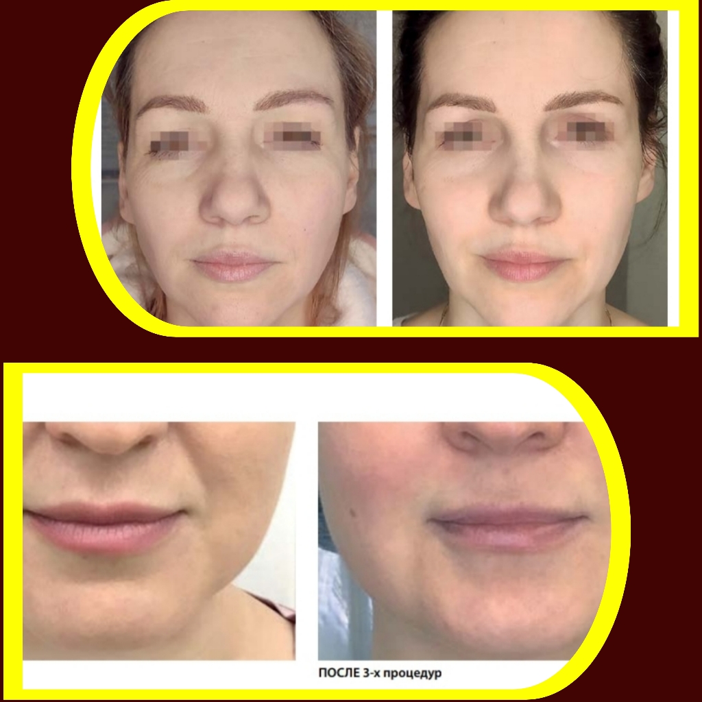 пластический массаж лица